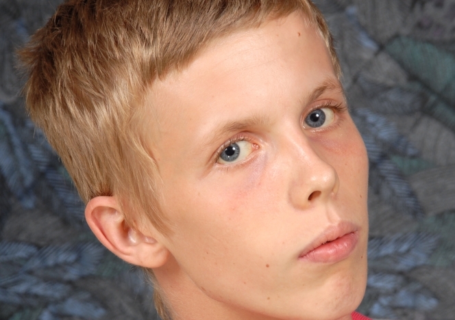 Abel foto #1